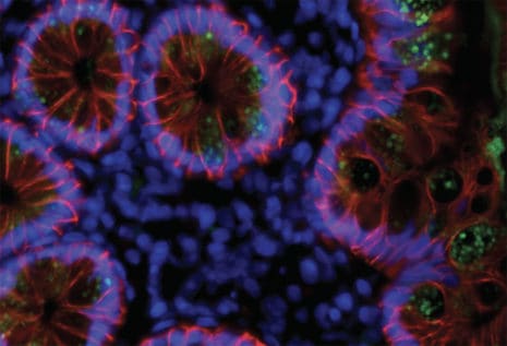 Covid-19 - układ odpornościowy zapewnia trwałą obronę po wyzdrowieniu 18 Coronavirus intenstines immunofluer2 - Odkrycia opublikowane w Nature dostarczają najsilniejszych jak dotąd dowodów na to, że układ odpornościowy „pamięta” wirusa i, co ciekawe, nadal poprawia jakość przeciwciał nawet po ustąpieniu infekcji. Przeciwciała wyprodukowane miesiące po zakażeniu wykazywały zwiększoną zdolność do blokowania SARS-CoV-2, a także jego zmutowanych wersji, takich jak wariant południowoafrykański.