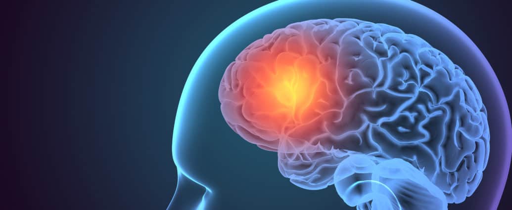 x ray head with highligh in the brain - Zaburzenia poznawcze, w tym otępienie, są coraz częściej zgłaszane jako powikłanie wysoce zaraźliwego wirusa SARS-CoV-2, który powoduje Covid-19, ujawnili naukowcy stojący za ostatnim badaniem w Cleveland Clinic w Ohio. 